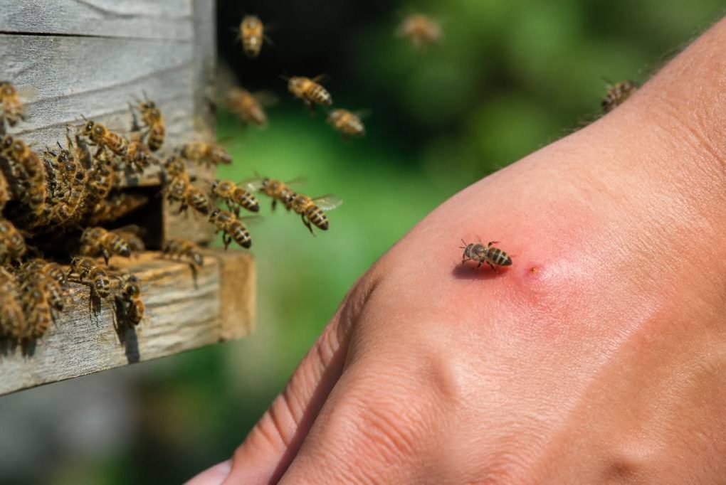 Abeille pique ou pas : comment reconnaître une piqûre et éviter les risques