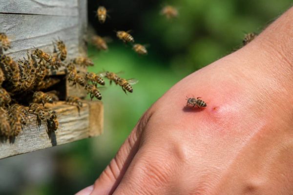 Abeille pique ou pas : comment reconnaître une piqûre et éviter les risques