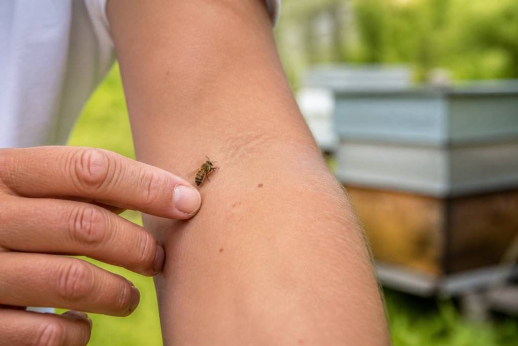 Apipuncture en apiculture : bienfaits, usages et techniques naturelles