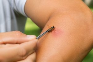 Piqûre d’abeille : que faire pour soulager la douleur et éviter les complications