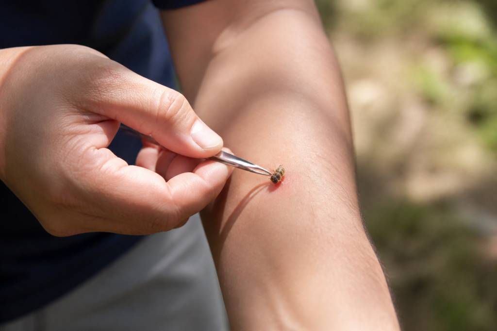 Que faire en cas de piqûre d'abeille : les gestes essentiels et les signes à surveiller